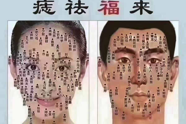 脸部黑痣算命图解