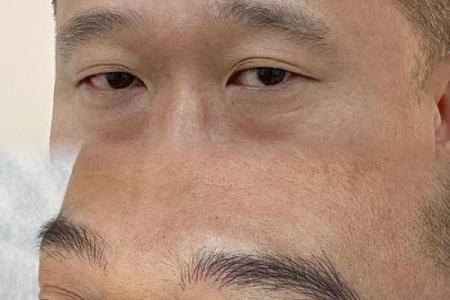 什么是倒八字眉？