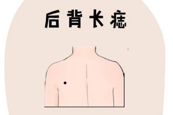 背上的痣图解算命