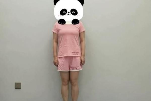内八字危害