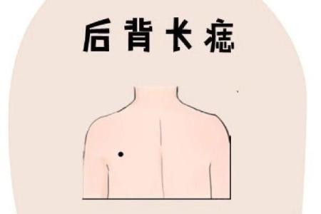 背上的痣图解算命