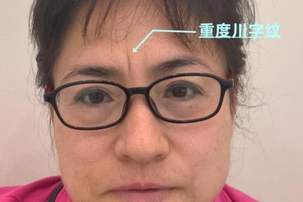 川字纹几种类型，一定要了解清楚：悬针纹、八字纹、双雀纹