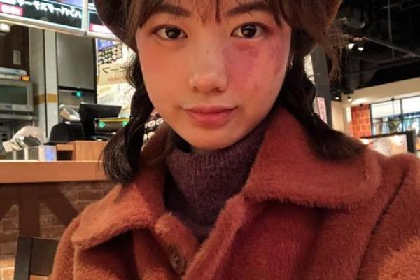 红色的胎记如何看相算命-