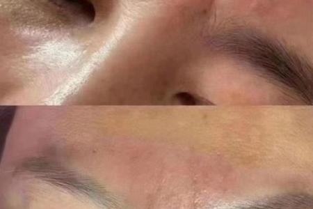 川字纹几种类型，一定要了解清楚：悬针纹、八字纹、双雀纹