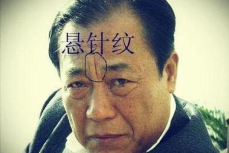 八字纹怎么去除