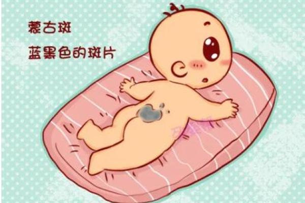 屁股上有胎记算命分析