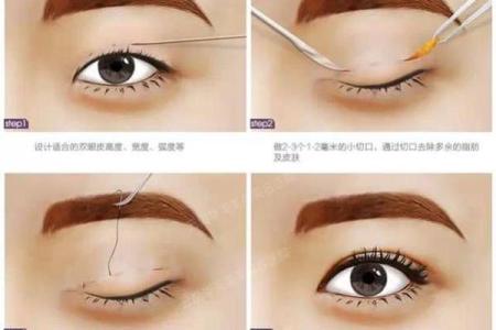 割双眼皮忌讳什么风水