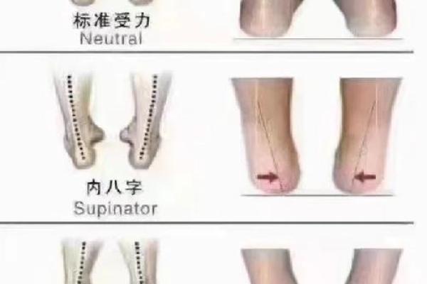 2岁八字脚