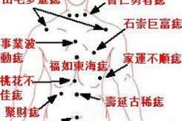 看黑痣算命