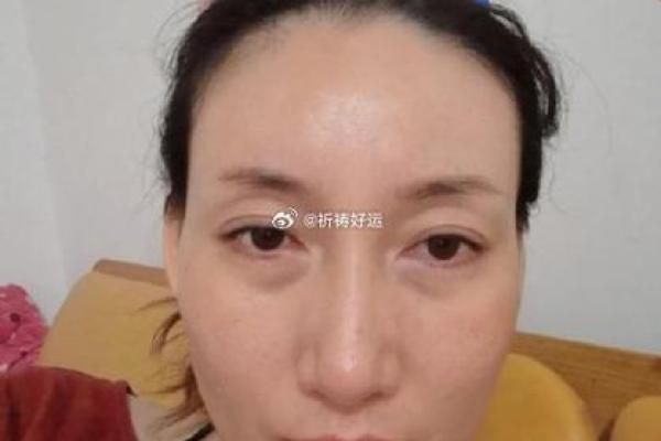 女人八字眼
