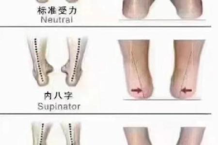 2岁八字脚