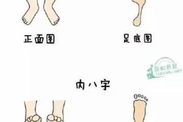 矫正外八字