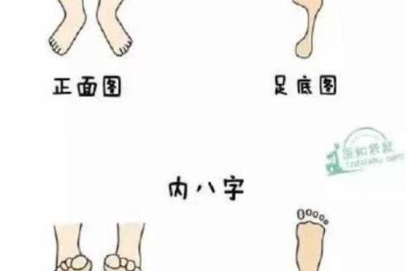 矫正外八字